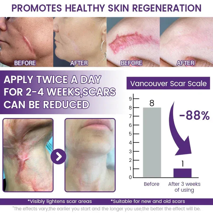 TiMilk - ReGen Scar Stem Cell Repair Gel (Imported)